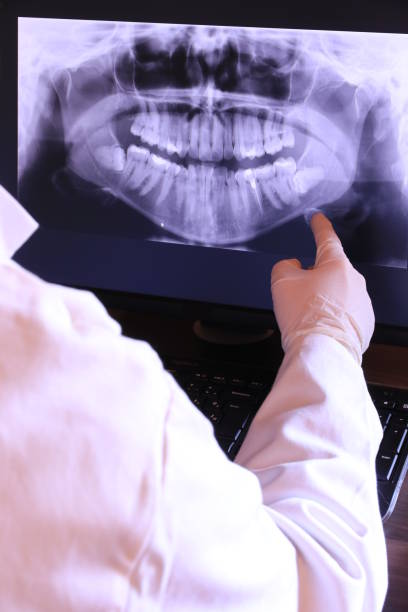 Best Emergency Wisdom Teeth Removal in Buxton, NC